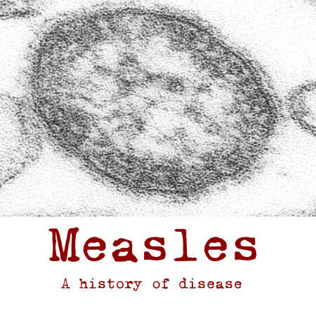 Measles, 