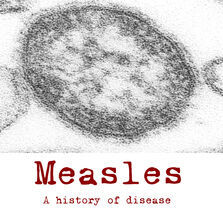 Measles, 