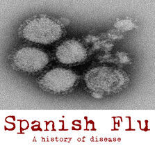 Influenza, 
