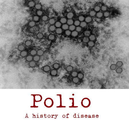 Polio, 